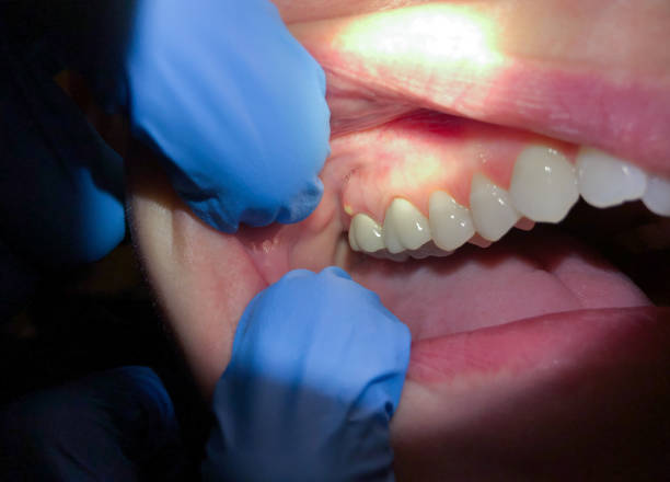 Best Broken Tooth Emergency  in Whiteville, TN