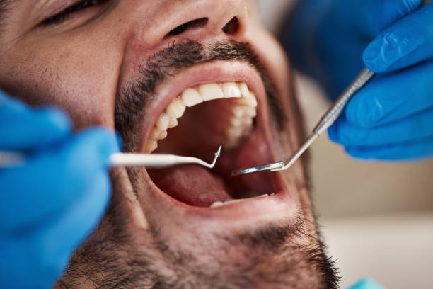 Emergency Gum Pain Relief in TN